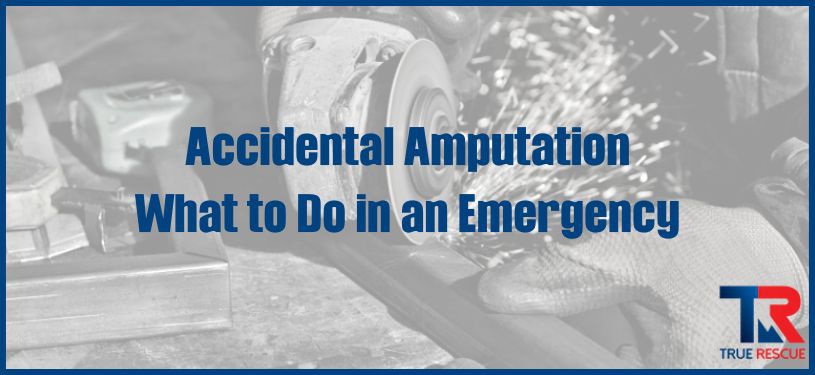 Accidental Amputation - What to Do in an Emergency