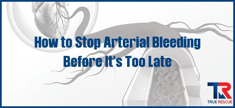 how to stop arterial bleeding