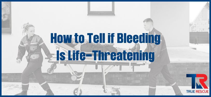 how to tell if bleeding is life-threatening