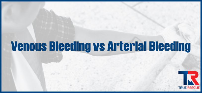 venous bleeding vs arterial bleeding